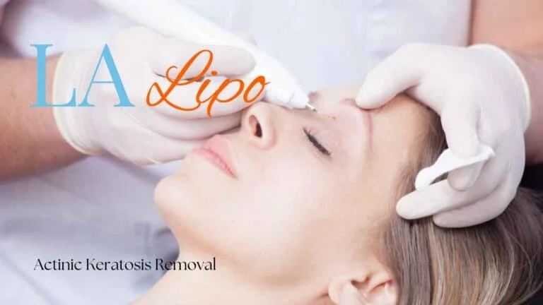 Woman receiving Actinic Keratosis Removal Treatment Ruislip Manor