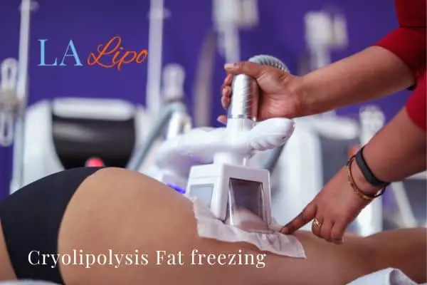 women getting fat freezing Ruislip Manor