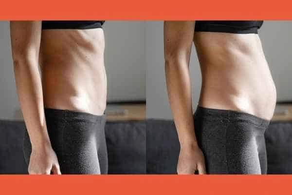 LA-EMS Body Sculpting results Ruislip Manor