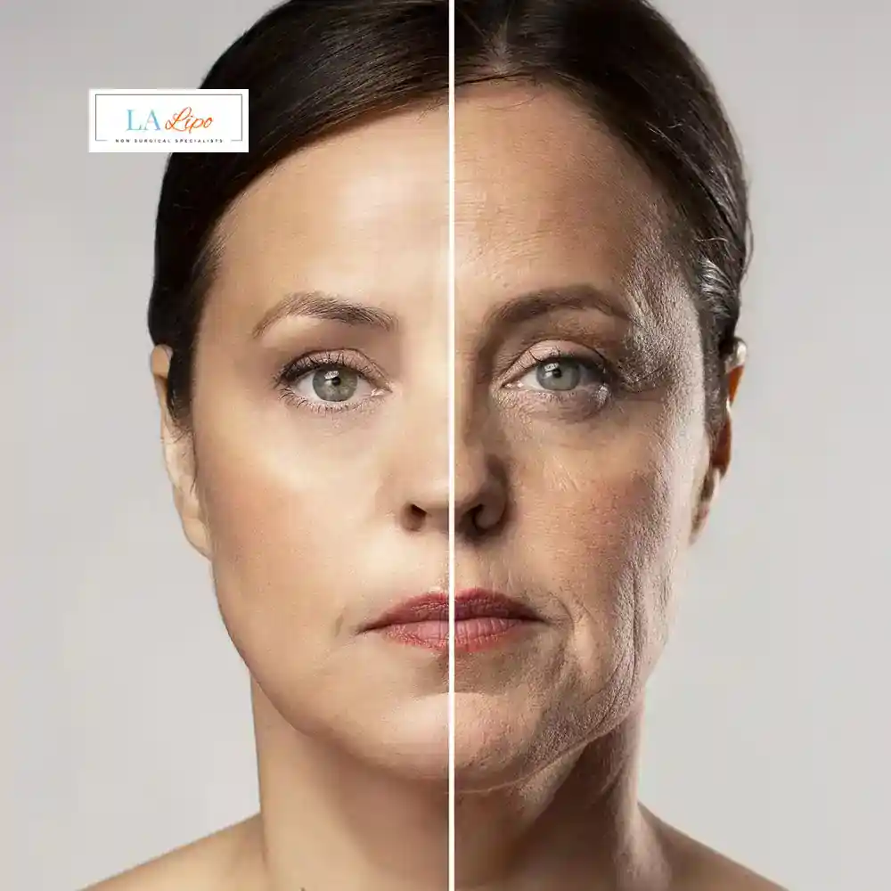 How Can You Tell If Non-Surgical Skin Tightening Is Right for You Ruislip Manor?