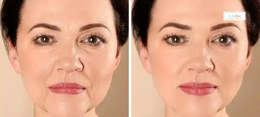 Why Aren’t My Skincare Products Making My Sagging Skin Look Firmer Ruislip Manor?