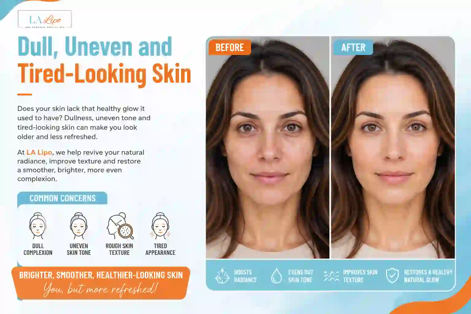 Sign #5: Dull, Uneven and Tired-Looking Skin Ruislip Manor