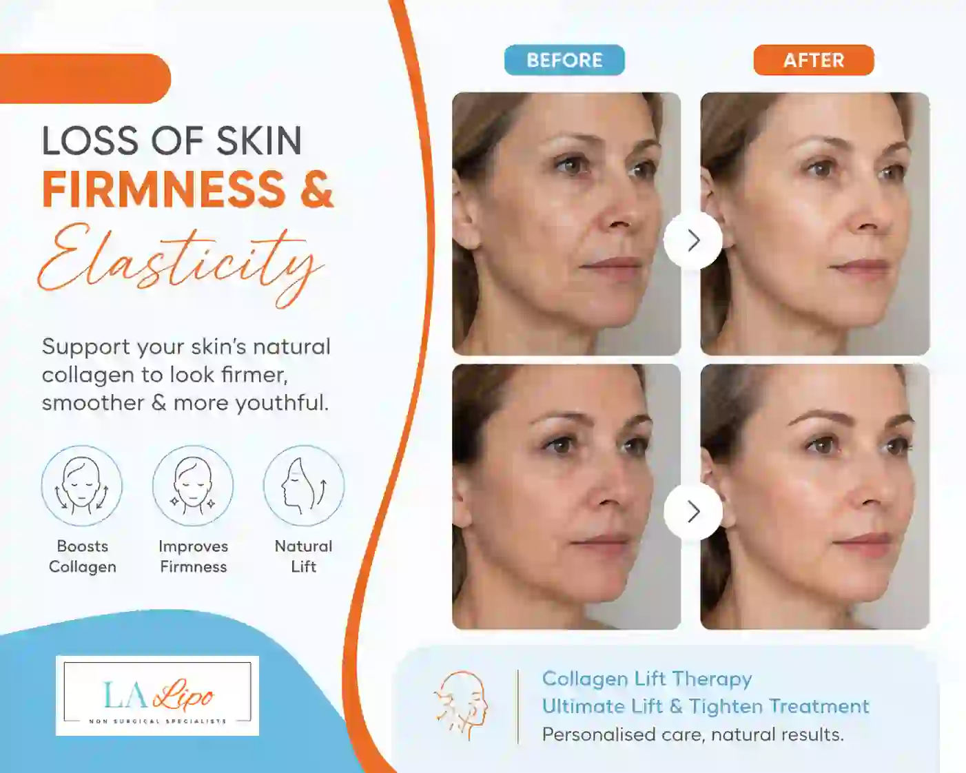 Sign #7: Loss of Skin Firmness and Elasticity Ruislip Manor